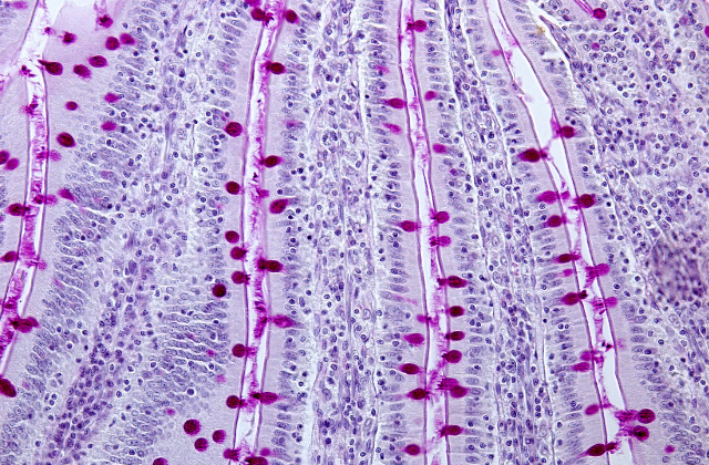 Mucosa intestinal