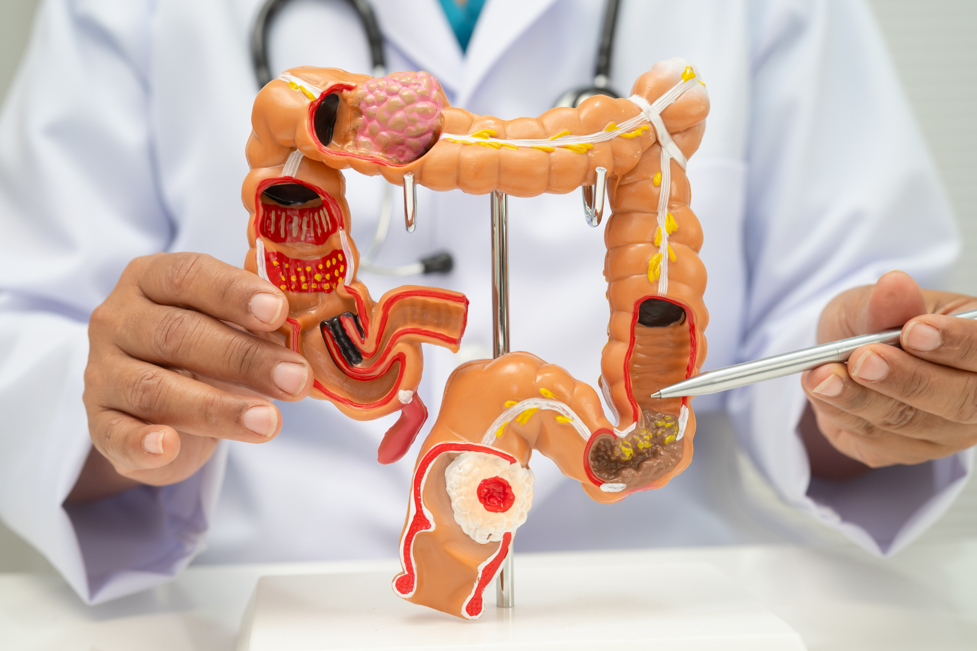 Imagen de intestino